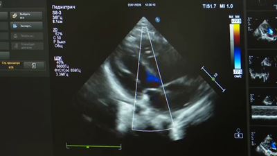 {Прооперировали двух детей }