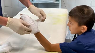 {Провели операцию на руке }