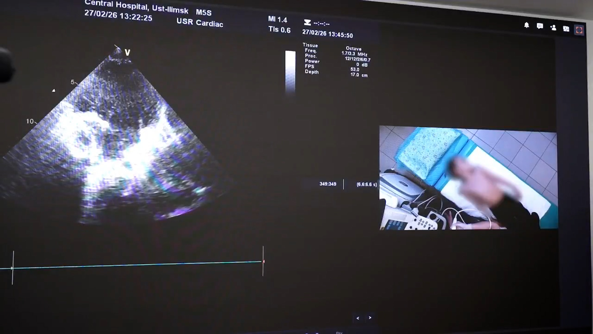 {Центр мониторинга детского здоровья}