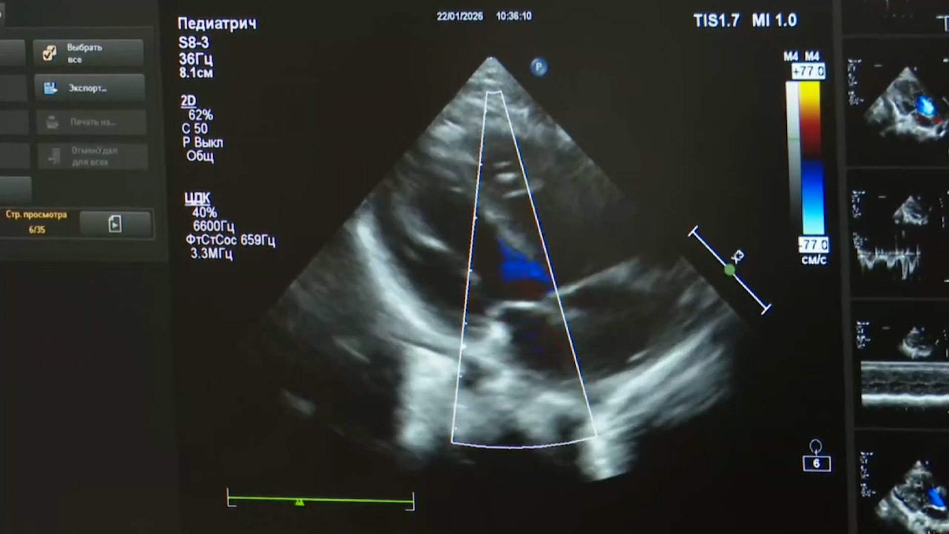 {Прооперировали двух детей }