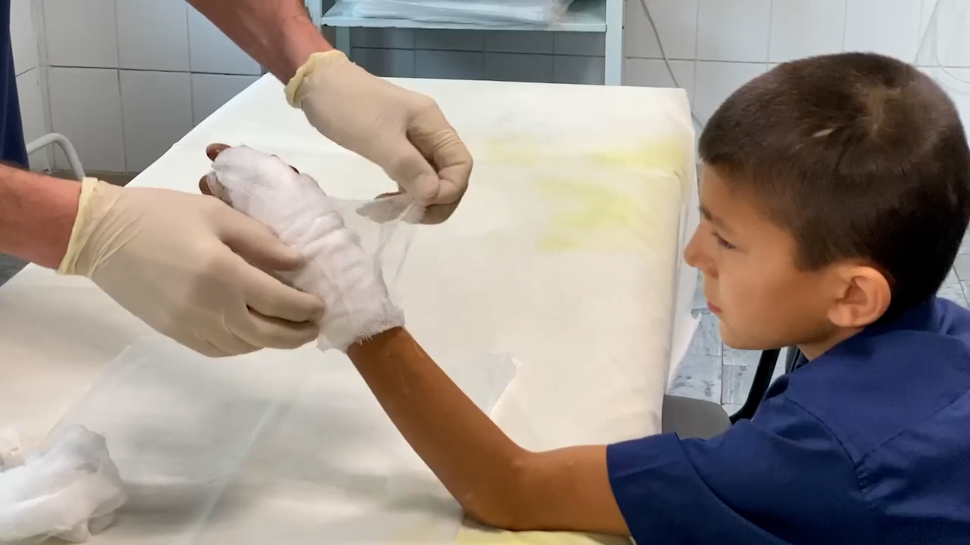 {Провели операцию на руке }